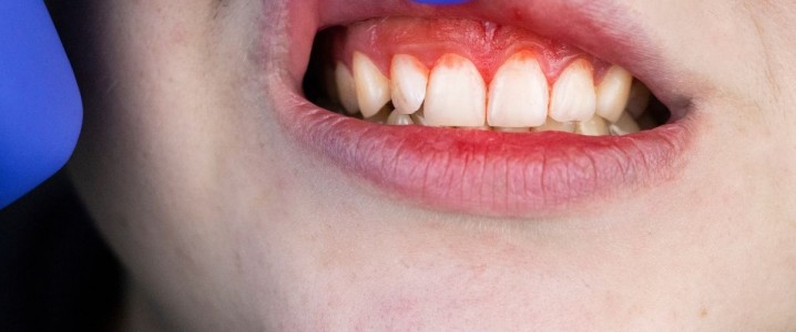 Periodontologia Clínica Rio Este