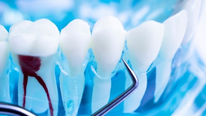 Endodontia Clínica Rio Este