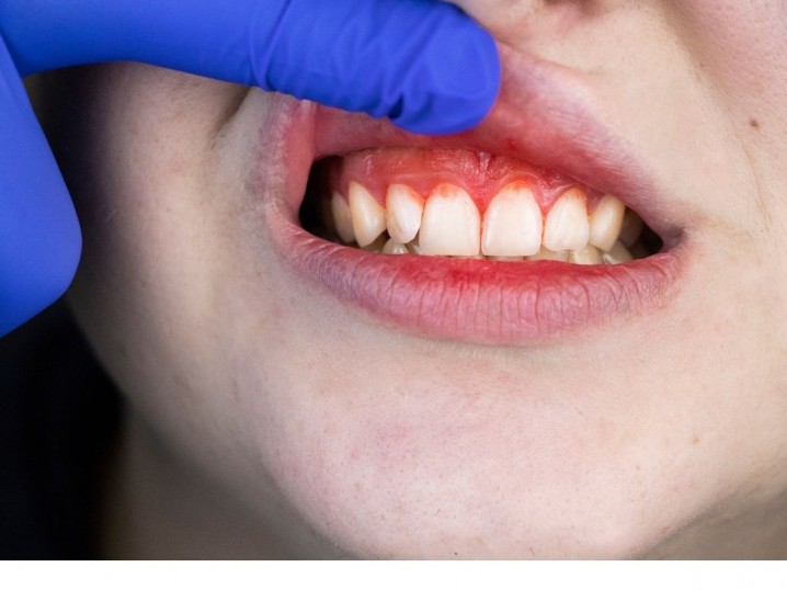 Periodontologia Clínica Rio Este