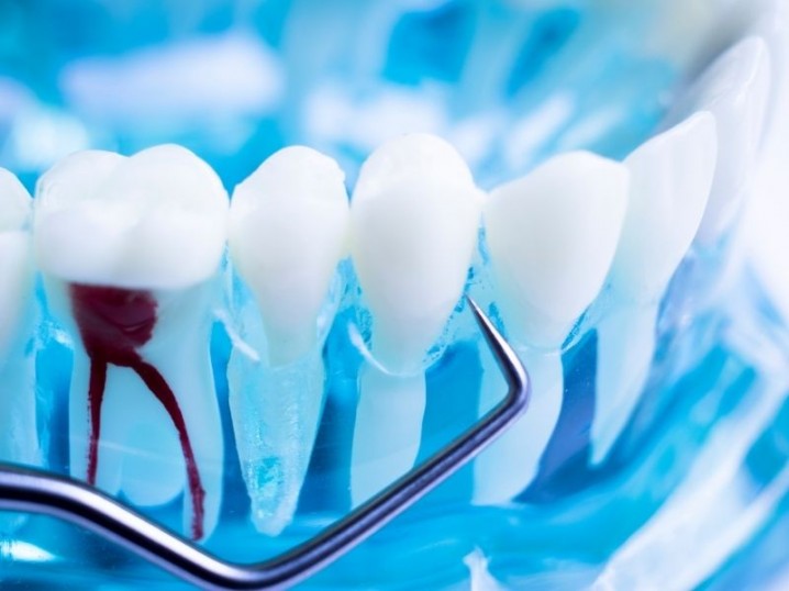 Endodontia Clínica Rio Este